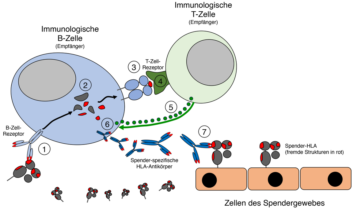 Interaktion von Spender-spezifischen HLA-Antikörpern mit Empfänger-Immunzellen